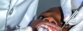 Ortodoncia infantil: ¿cuándo se recomienda el tratamiento?